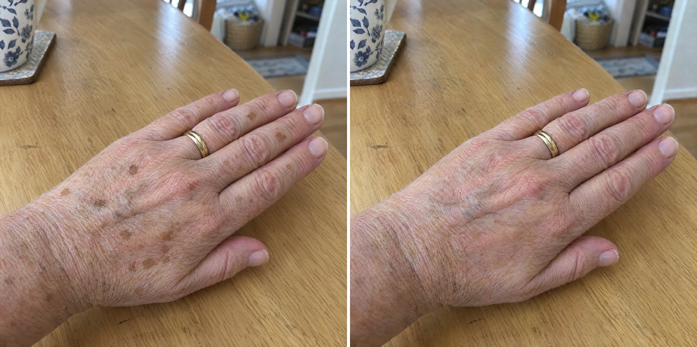 Customer photos, hands