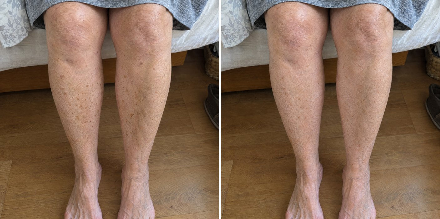 Customer photos, legs
