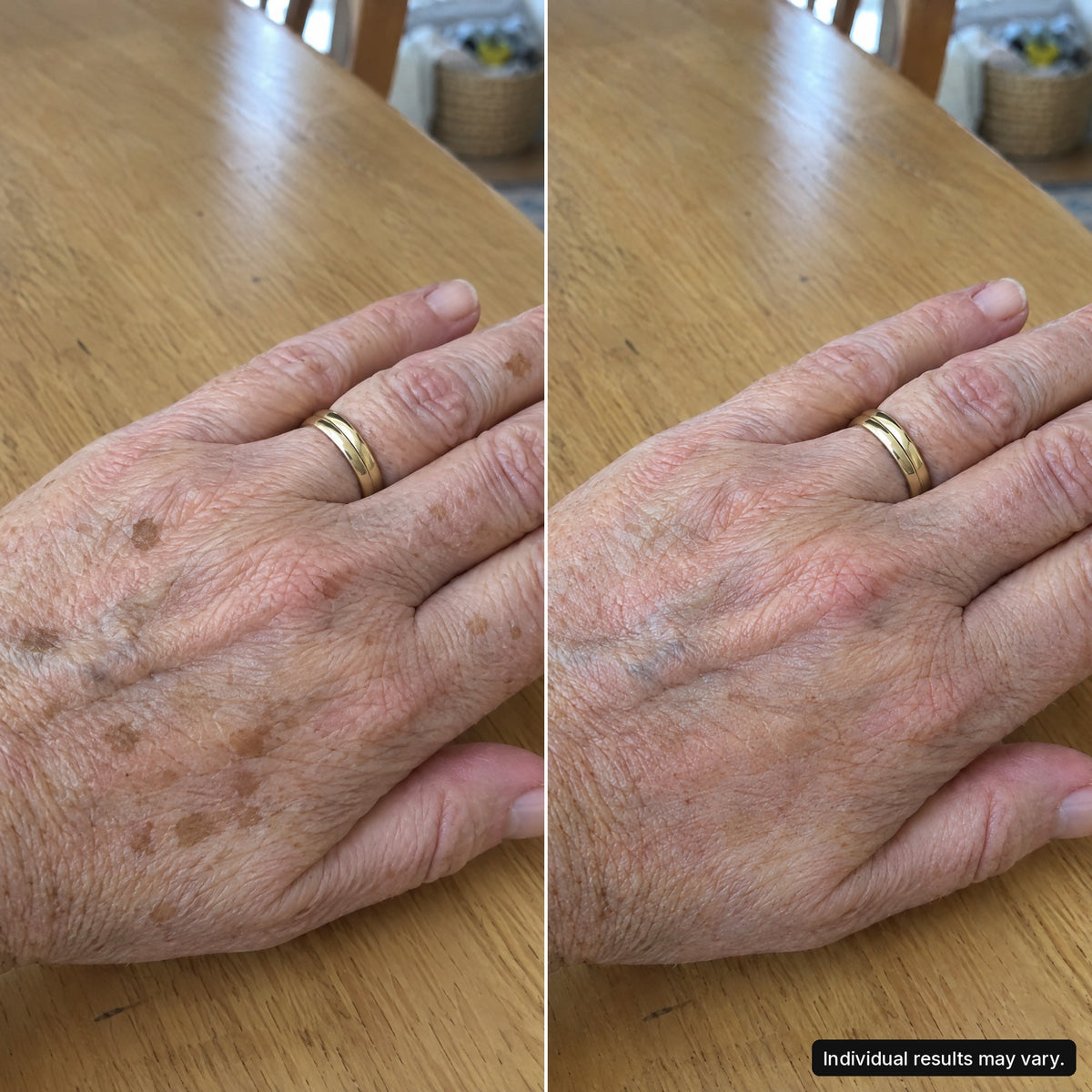 Customer photo, hands, 8 weeks