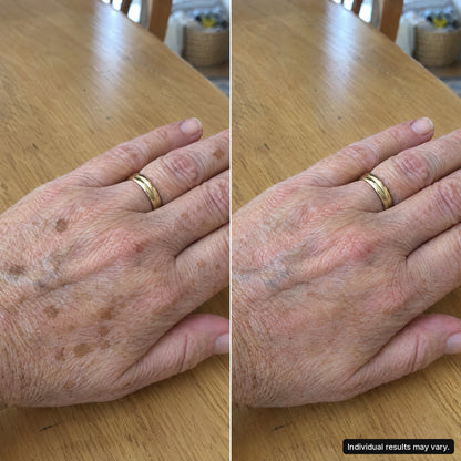 Customer photo, hands, 8 weeks