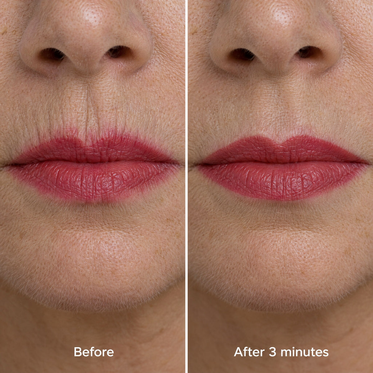 Smoker lines before and after: lipstick no longer bleeds
