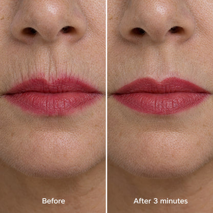 Smoker lines before and after: lipstick no longer bleeds