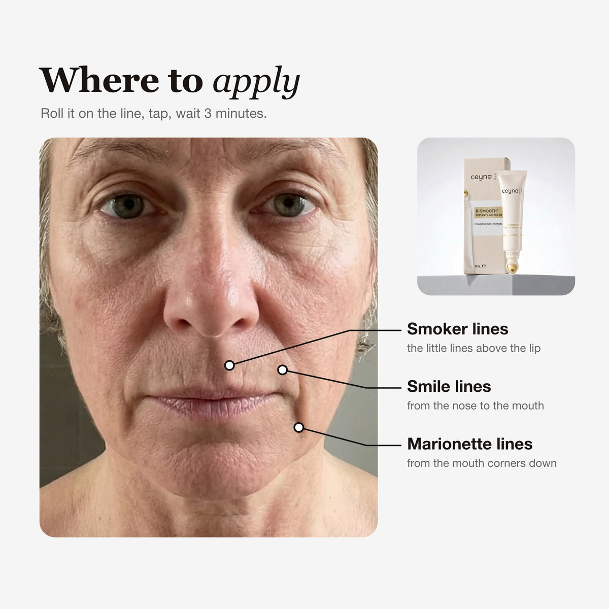 Where to apply: smoker lines, smile lines, marionette lines