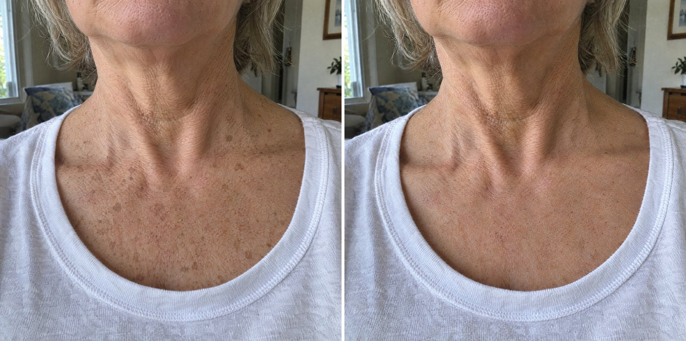 Customer photos, chest