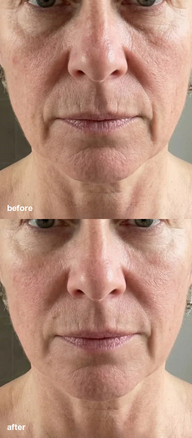 Before and after K-Smooth